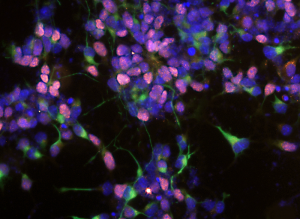 cellule nervose