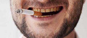 fumo sigaretta denti