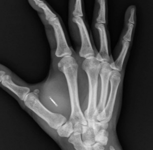 chip mani svezia