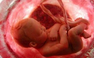 aborto new york