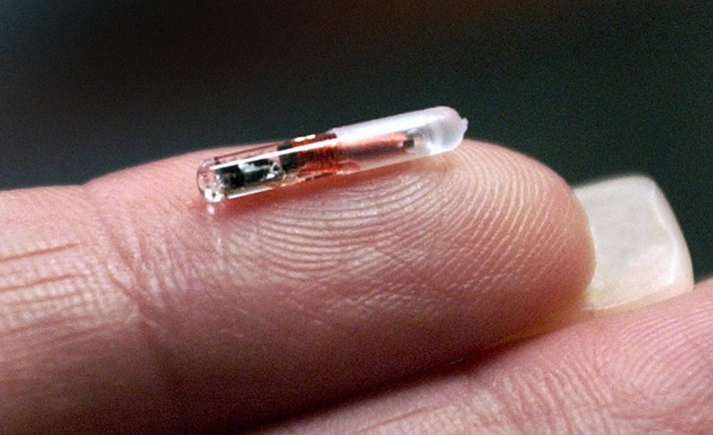 Un chip impiantato sotto pelle per riconoscere la tua identità, quando il futuro è dentro di noi