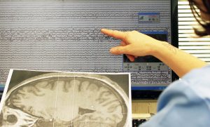 tracciato epilessia Bambino Gesù