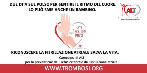 fibrillazione atriale