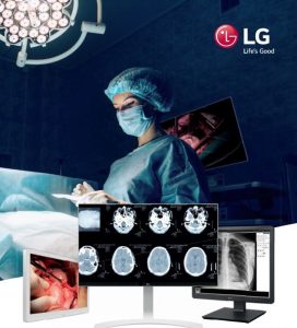 monitor lg