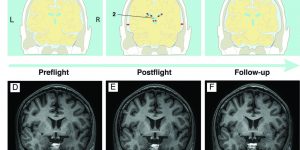 viaggi spaziali cervello