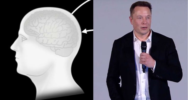 neuralink Elon Musk