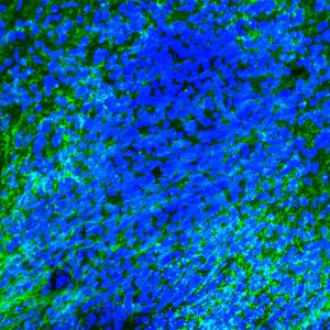 Sclerosi multipla nuova luce sul ruolo della microglia nella riparazione della mielina
