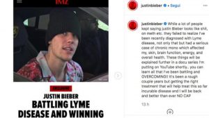 Justin Bieber malattia