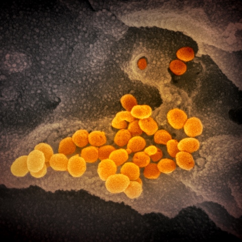 coronavirus