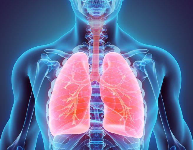 embolia polmonare