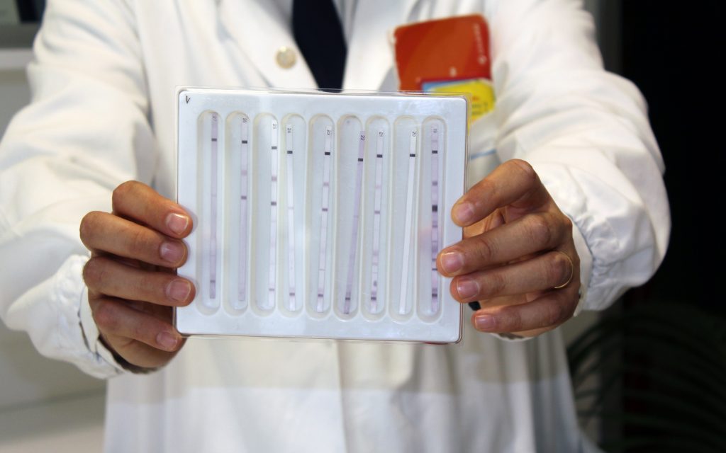 test hiv istantaneo