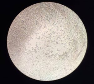 coronavirus vitro