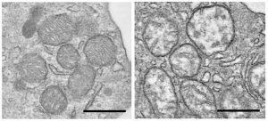coronavirus unimore