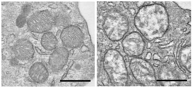 coronavirus unimore