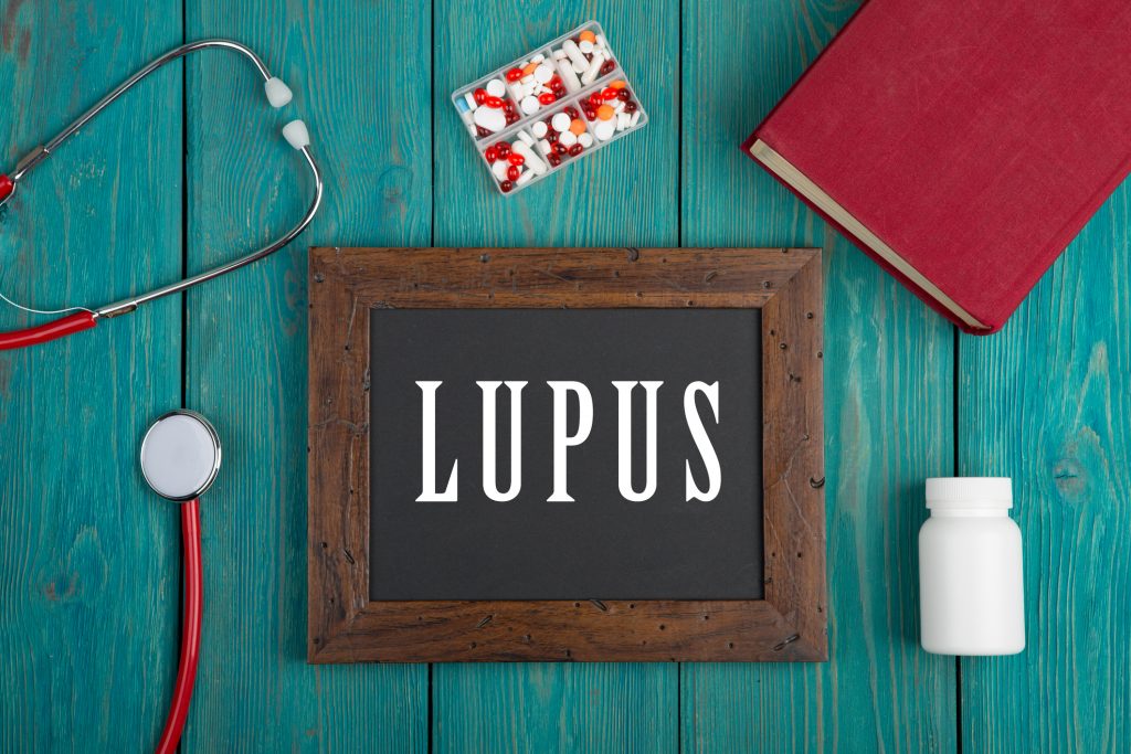 malattia lupus