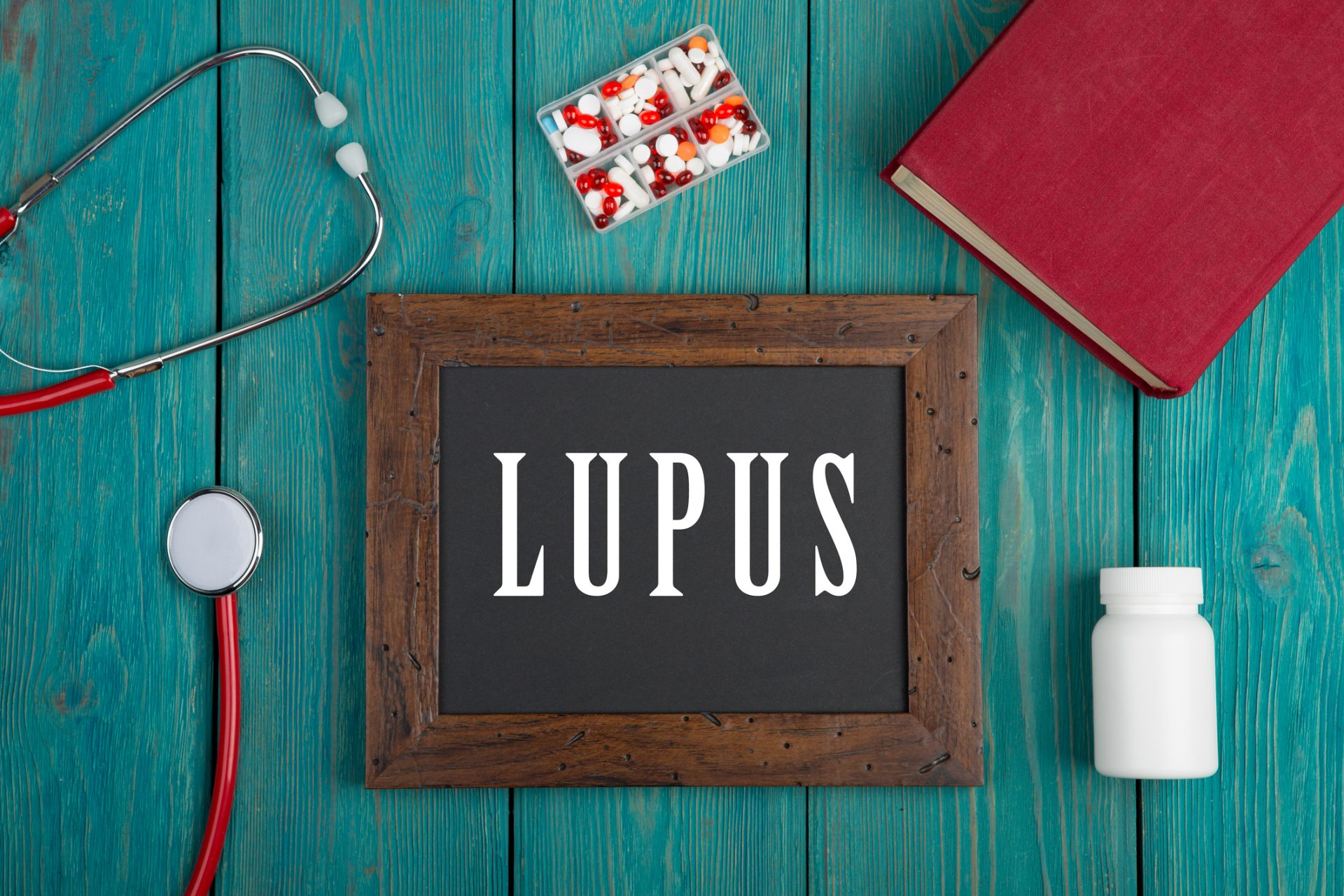 Lupus, cos'è e come riconoscerlo? Sintomi