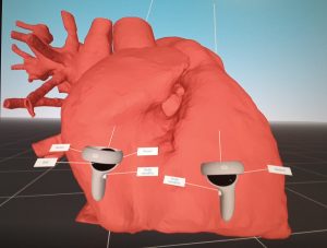 cardiochirurgia pediatrica