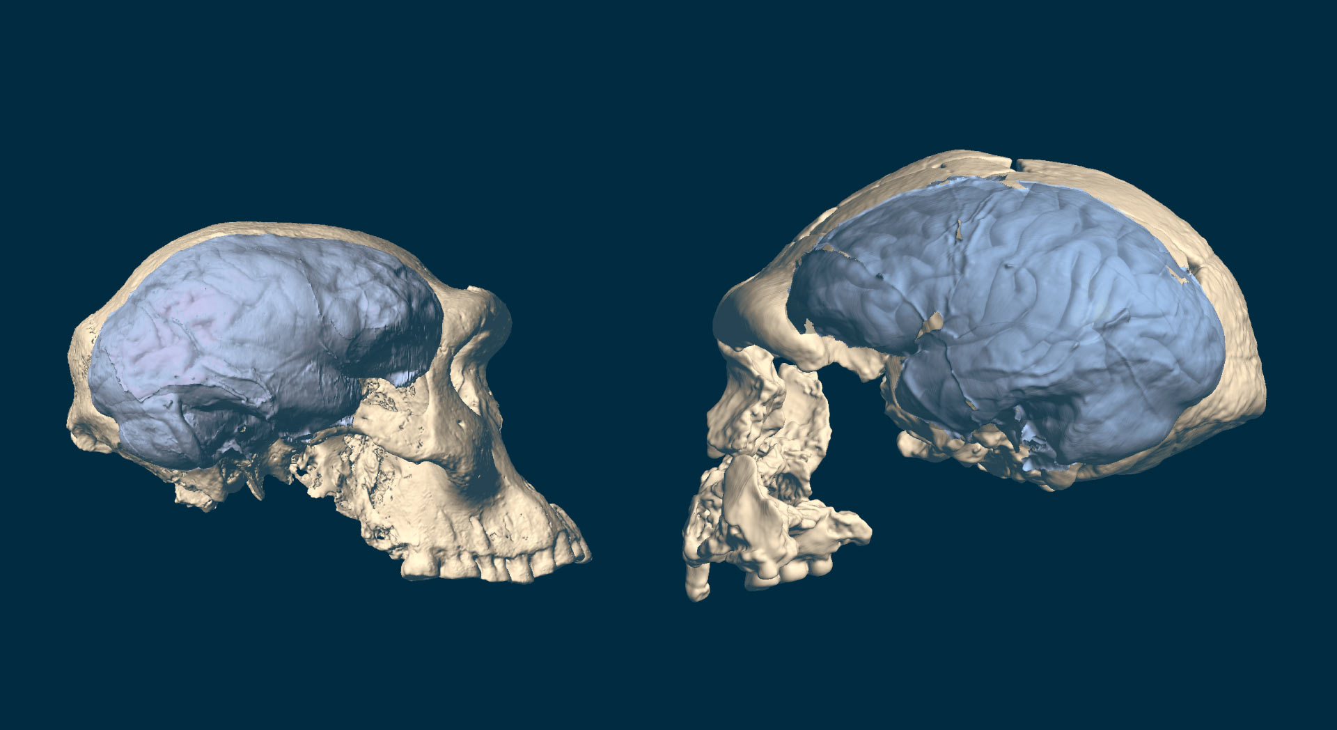 cervello umano scimmie