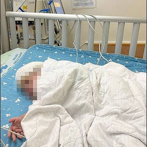 gemelle separate operazione israele