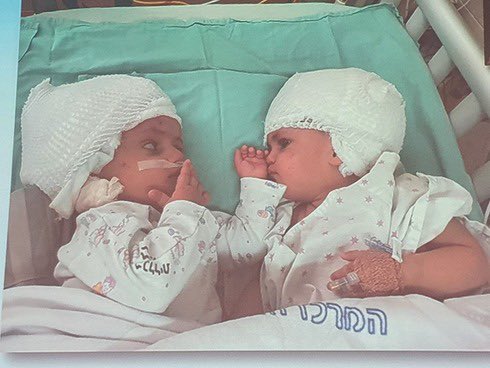 gemelle separate operazione israele