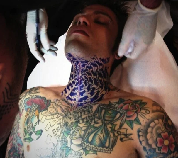 fedez tatuaggi demielinizzazione