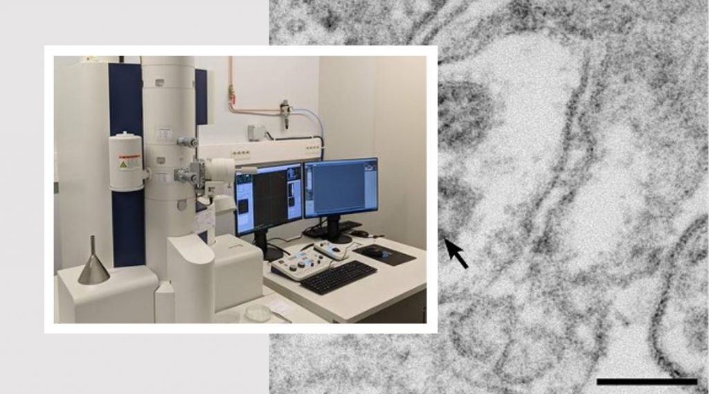 microscopio covid