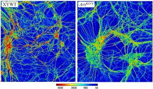 ricerca cnr neurologia