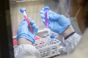 Laboratorio malattie rare ricerca medica