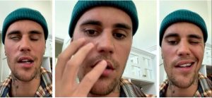 bieber
