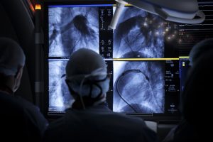 Un momento in sala di emodinamica con la nuova tecnologia