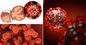 coinfezione hiv covid vaiolo scimmie