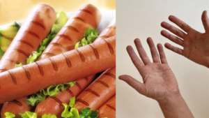listeria wurstel