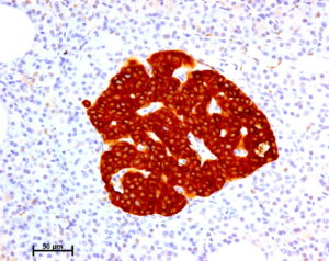 Isole pancreatiche