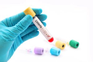 listeria