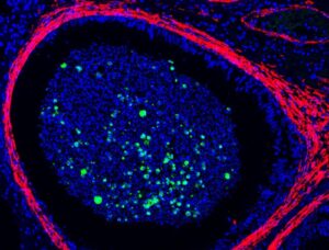 virus vaiolo delle scimmie testicoli