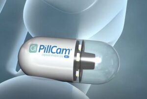 capsula endoscopica