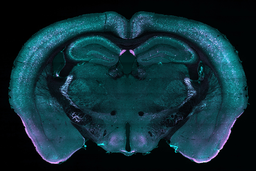 digiuno cervello