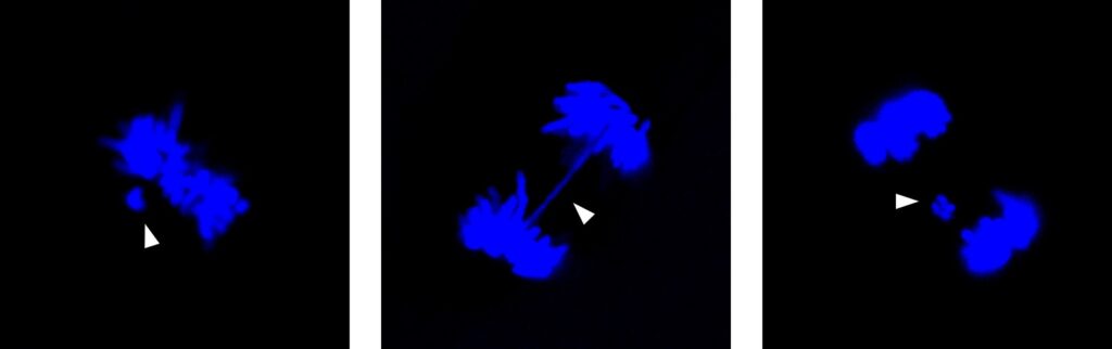 osteosarcoma cnr