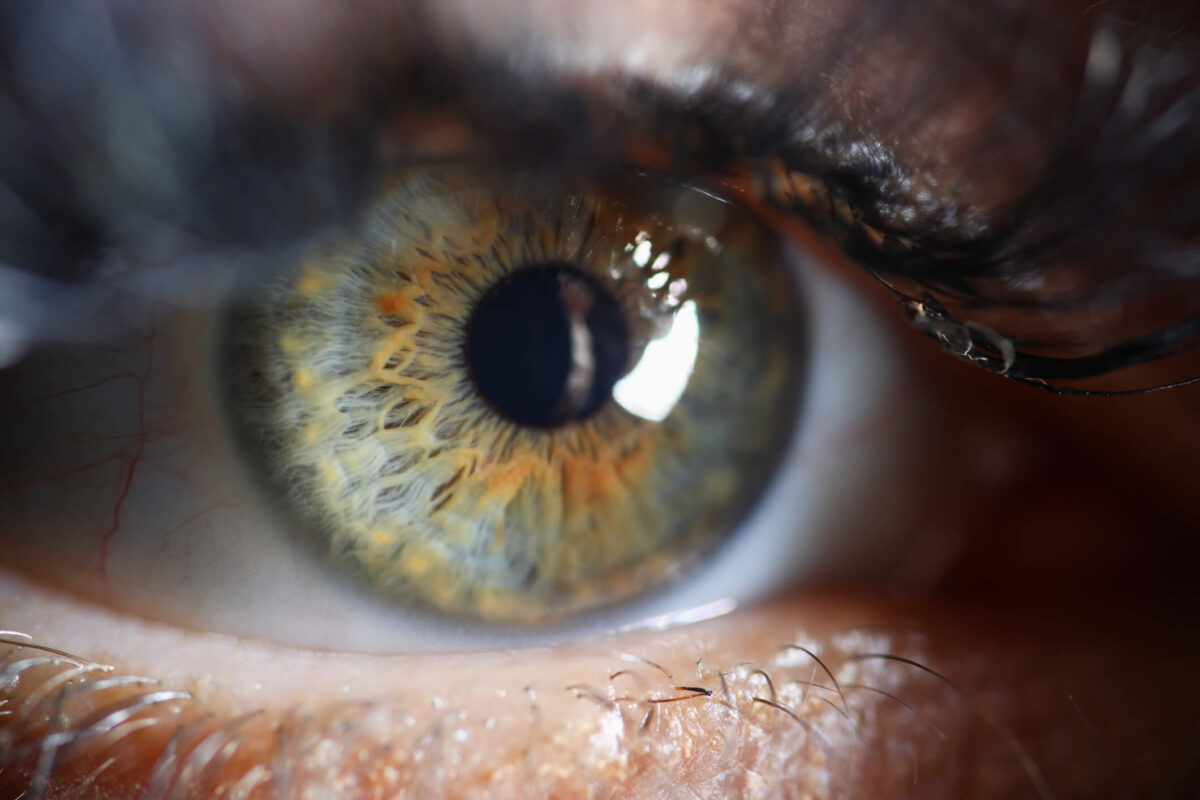 salute della retina - occhi