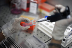 ricerca medica allergia malattia genetica