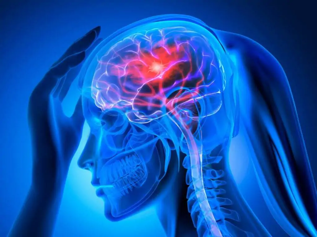 Giornata europea di sensibilizzazione sull'ictus