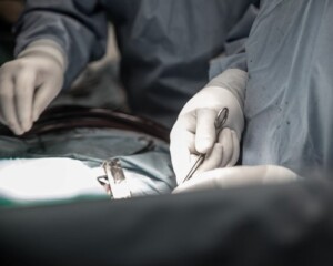 Ricostruito esofago cervicale con lembo di muscolo pettorale
