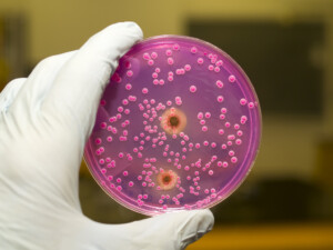 covid candida