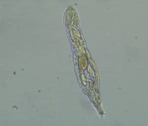 rotiferi bdelloidei