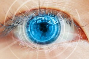 lenti intraoculari