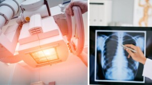 ENEA progetto per ridurre esposizione dei pazienti ai raggi X