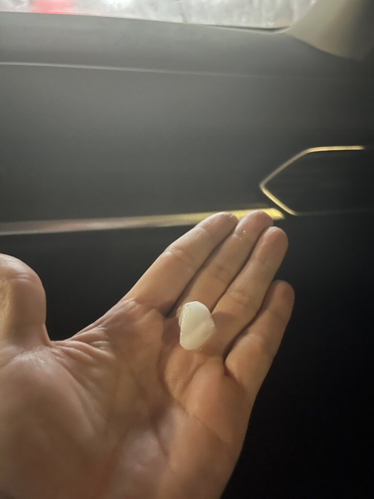 maltempo grandine bogotà colombia