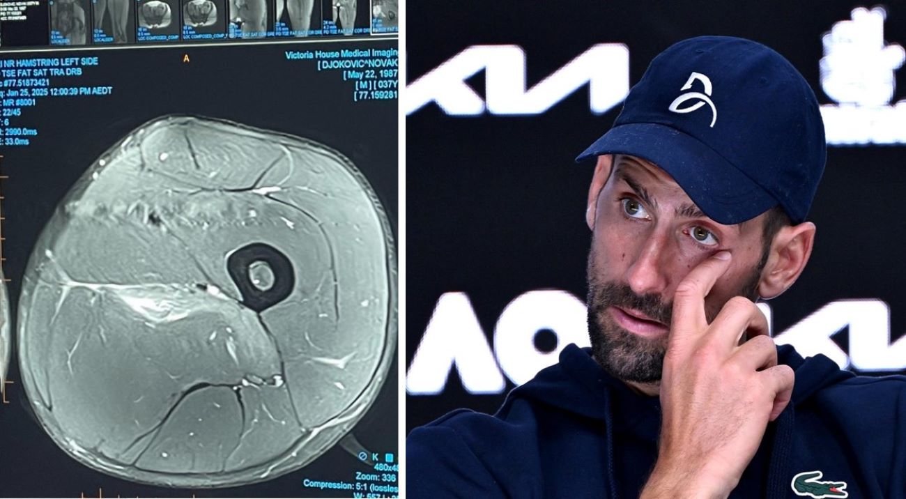 Preoccupazione e sospetti sulla salute di Djokovic: cosa è emerso dall’ecografia