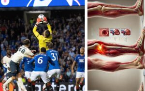 Portiere emorragia interna piede