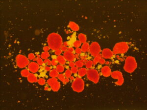 Isole pancreatiche
